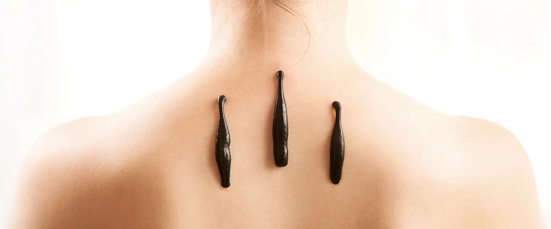 Das Mädchen mit Blutsaugern auf dem Rücken vor weißem Hintergrund